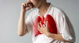 IMAGEN DE https://www.stellamaris.com.pe/vida-saludable/noticia/tuberculosis